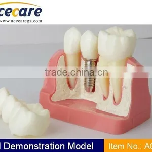 Dental Model thumbnail-1