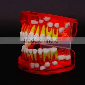 Bicolor Deciduous Teeth Development Model 1Teaching Demonstration Models thumbnail-2
