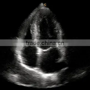 2016 New Portable Color Doppler(Optional 4D) for Cardiac Use thumbnail-5