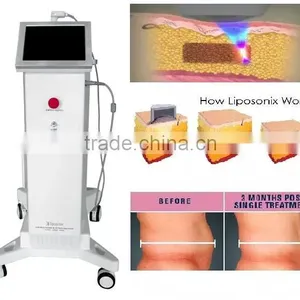 Nasolabial Folds Removal Liposonix High Intensity Focused High Frequency Acne Machine Ultrasound HIFU Body Slimming Machine Face Lifting thumbnail-5
