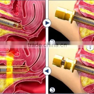 0.1-2J Portable Safety Color Touch Screen Vaginal Rejuvenation HIFU / HIFU Machine High Intensity Focused Ultrasound thumbnail-5
