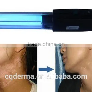Home Use Portable UV Phototherapy 311nm Narrow Band Uvb Lamp for Psoriasis Treatment Vitiligo Treatment thumbnail-2