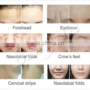 LM-E300A Portable Skin Tightening Radio Frequency Body Machine thumbnail-6