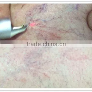 2016 New 980nm Diode Laser for Vascular Removal Blood Vessels Removal/anti-redness Remover/skin Care thumbnail-2
