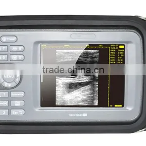 5.5 Inch TFT Color LCD Monitor Hand Held Ultrasound Scanner HandScan H8 With CE Approved thumbnail-1