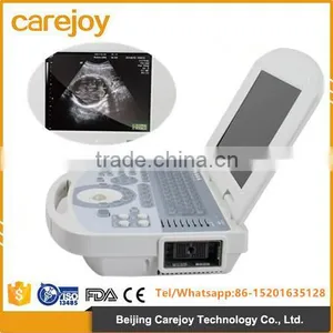CE& FDA Approved Digital Portable Ultrasound Scanner Suitable for the Diagnosis of Abdomen, Cardiac, Gynecology, Obstetrics thumbnail-1