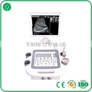 Trolley Ultrasound Scanner / Ultrasound 3018II thumbnail-3
