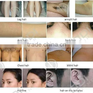 Professional Salon Equipment for Men 808nm Diode Laser Hair Removal OD-GL808 thumbnail-6