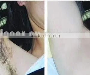 QTS Alexandrite Laser Hair Removal Machine Price With CE thumbnail-3