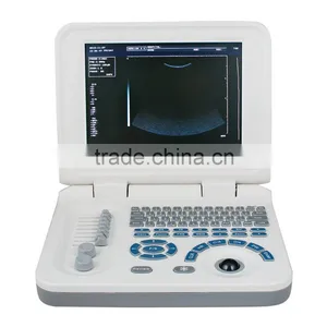 RUS-9000F2 CE&ISO Easy Carrying Portable Ultrasound Scanner Price thumbnail-2