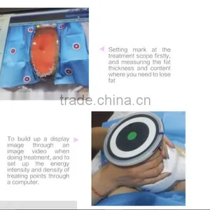 Ultrashape New Slimming Technology Machine Cavitation Slimming Machine thumbnail-2