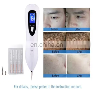 Mini Skin Tag Remover Device Portable Spider Vein Beauty Pen Mole Removal Machine for Skin Care thumbnail-3