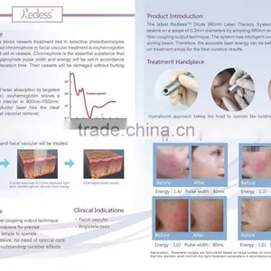 High Quality Vascular Removal Machine 15W 980nm Spider Veins Removal thumbnail-6