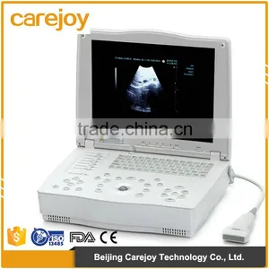 Hospital Clinical Equipment 15-inch Full Digital Laptop Ultrasound Scanner China Made Portable Ultrasound Machine thumbnail-1
