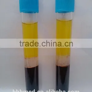 Non-pyrogen 10ml ACD Anticoagulation Prp Kit Quality Choice thumbnail-2