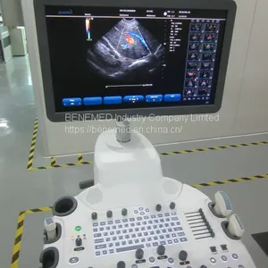 Trolly 2D Echocardiography Color Doppler Ultrasound Scanner Diagnosis Equipment thumbnail-3