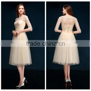 2015 Casual Cocktail Party Designer One Piece Party Dress thumbnail-1
