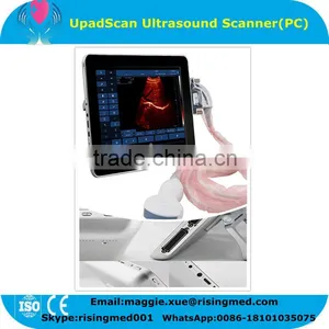 CE Approved 9.7 Inch Touch Screen Ultrasound Scanner UpadScan Optional Convex Micro-convex Linear Transvaginal Probe thumbnail-1