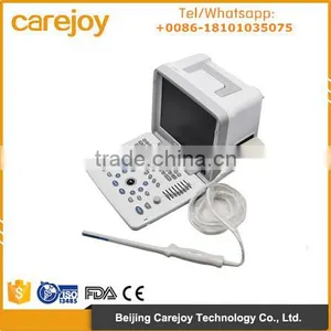 CE Approved 18 Months Warranty 12 Inch Portable Ultrasound Machine With Multi Frequency Probe for Hospital Clinic Community thumbnail-1