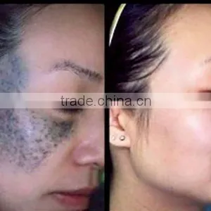 2017 New Q Switch Nd Yag Laser Tattoo Tattoo Removal Laser Machine Removal Machine For Permanent Makeup Brown Age Spots Removal thumbnail-6