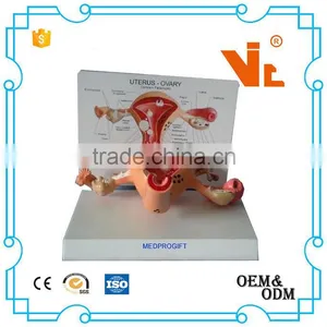 V-AM023 Anatomical Uterus Ovary Care Model thumbnail-1