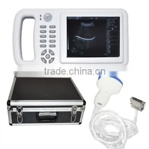 Compact Handheld Ultrasoud Scanner RUS-8000A 3.5MHz Convex Array Probe Made-in-China thumbnail-1