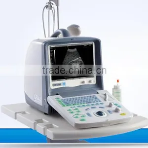 Portable Handheld Laptop Portable Ultrasound Scanner thumbnail-1