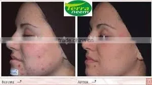 GUARANTEED NATURAL & PURE NEEM OIL thumbnail-3