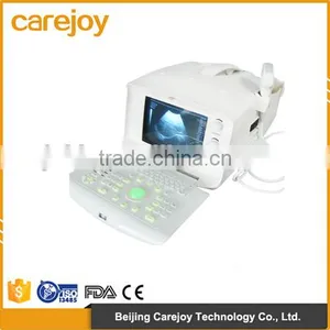 Factory Price!!CE Approved 3.5Mhz Multi-frequency Convex Probe Portable B-Mode Ultrasound Scanner System thumbnail-1