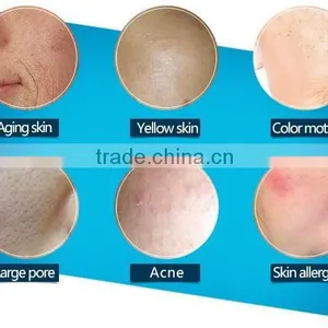 Medical Laser Rf Fractional Co2 Laser Spot Scar 10.6um Pigment Removal Machine/supercritical Co2 Extraction Machine Skin Renewing 8.0 Inch thumbnail-6