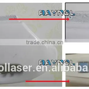 Best SSR and SHR Pore Remover IPL Beauty Machine thumbnail-6