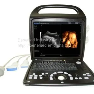 Portable 4D Color Doppler Ultrasound Scanner BENE-3V thumbnail-2