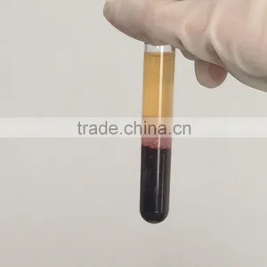High Concentration Platelet Rich Plasma PRP Tube Supplier's Choice thumbnail-3