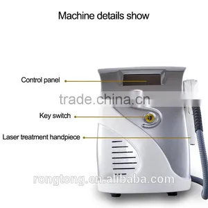Telangiectasis Treatment Mini Laser 2015 Newest Nd Yag Laser Hot Selling EO Q Switch Nd:YAG Laser Machine Q Switch Laser Machine thumbnail-2