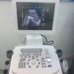 Cheap Trolley Ultrasound Scanner for Obsterics thumbnail-5