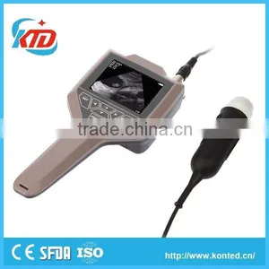Multifunctional Ultrasound Equipment 4d for Wholesales thumbnail-1