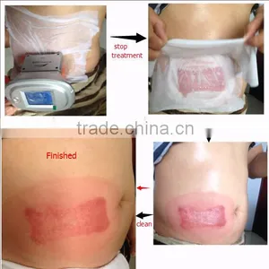 4 Handles Professional Cryolipolysis Device With 2 Heads Working Simultaneously thumbnail-2