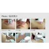 940nm Infrared Laser RF Cellulite Reduction, Body Shaping Machine for Face, Arm or Leg thumbnail-1