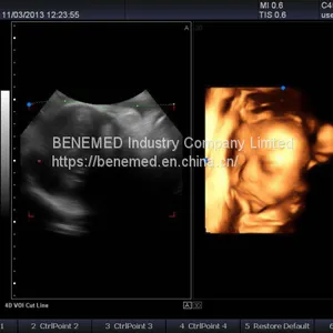 Trolly Based Color Doppler System Ultrasound Diagnostic Scanner thumbnail-3