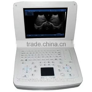 Sonostar Good Quality Handheld Portable Vet Ultrasound Scanner Pig Veterinary Ultrasound V10(SS-10V ) thumbnail-2