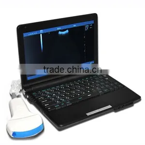 Cheap Laptop Veterinary Ultrasonic Machine VET Ultrasound Scanner 6.5MHz Rectal Linear Probe 3.5MHz Convex Probe thumbnail-2
