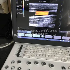 High Quality Ultraslim Notebook Type Black and White Ultrasound Scanner thumbnail-1
