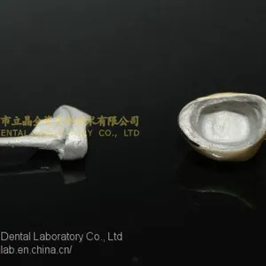 Full Metal Post Core, Full Ceramic Post Core, Richmond Crown, Cast Metal Crown, Dental Prostheses, Laboratorio Dental, Dental Laboratory, Dentallabor, LJ Dental Lab China thumbnail-3