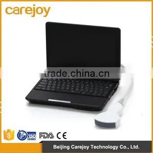 CE*ISO Approved Laptop Ultrasound Machine With 3.5Mhz Convex Probe With Battery thumbnail-1