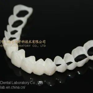 CAD/CAM PMMA Resin Clip on Veneers, Snap-on-veneers, Smile Veneers, Laboratoire Dentaire, Dentallabor, Laboratorio Dental, Dental Laboratory, Shenzhen LJ Dental Lab China thumbnail-4