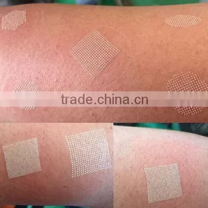 Sanhe Fractional Laser Co2 Skin Tightening System/ Co2 Glass Laser Tube thumbnail-3