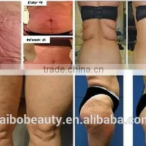 220 / 110V Cheapest!!! Cryolipolysis Fat Freezing Machine/fat Lose Weight Freezing Liposuction Machine/slim Freeze Belt thumbnail-6