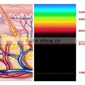 ICE SHR SSR Hair Removal Skin Rejuvenation Pigmentation&Vascular&Acne&Spot Removal Beauty Salon Equipment&Machine thumbnail-6