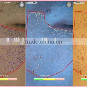 3D Intelligent Skin Analyzer Machine Best Selling Skin Analyzing Equipment thumbnail-5