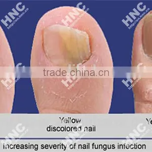 Nail Infection Control Products Made in China Market thumbnail-6